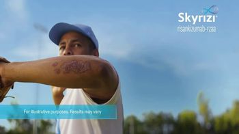 SKYRIZI TV Spot, 'Baseball: $0 per Dose'
